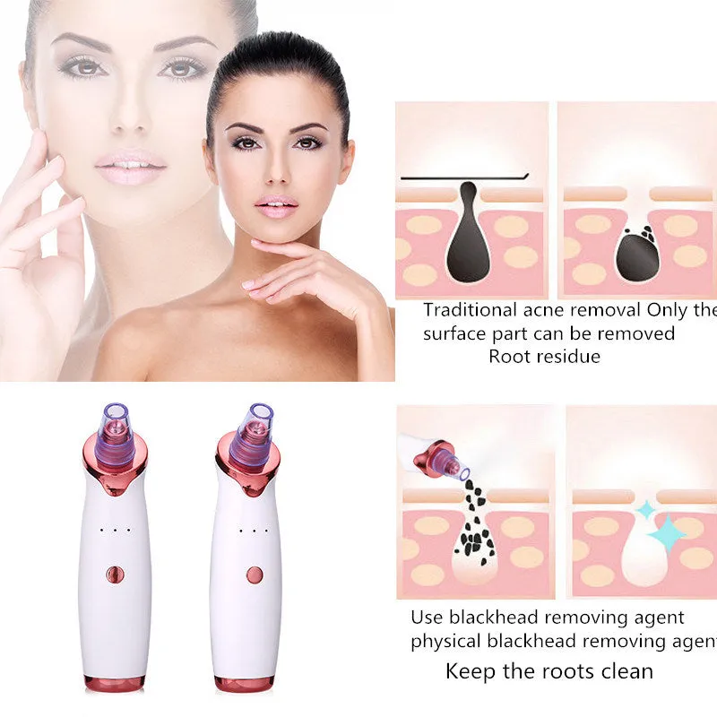 Dot Remover Acne Vacuum Suction Face Clean Black Head Pore Cleaning Beauty Skin Care Tool